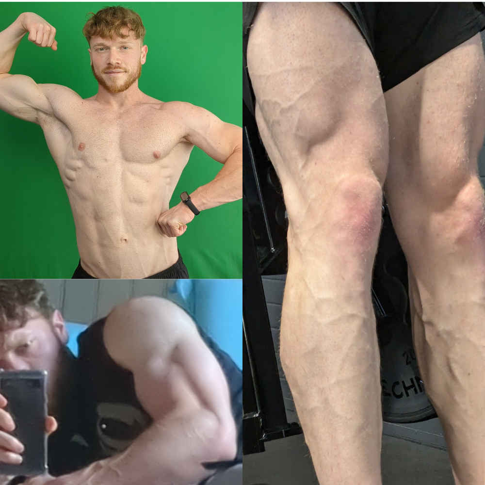 Par exemple, quand je faisais 77 kg avec 7 % de masse grasse, ce qui ne paraît pas être beaucoup, j’avais en réalité encore 5,39 kg de graisse, soit 48 510 kcal d’énergie disponible.